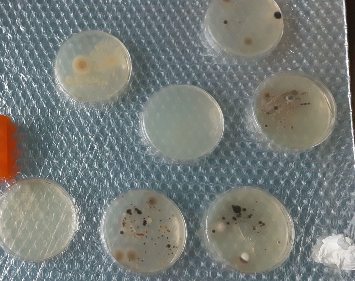 CRISPR Results! 크리스퍼 결과! (24&nbsp;HRS)